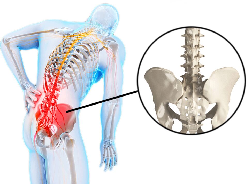 Spinal pathologies are a common cause of lumbar pain