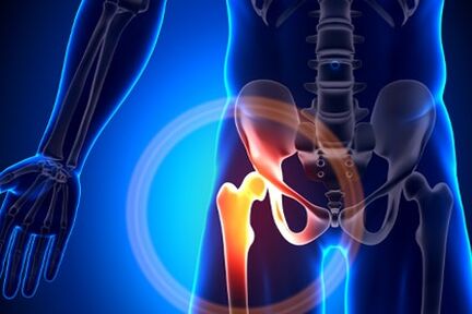 Pain in the hip joint