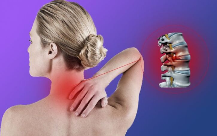 Inflammation of the spine with cervical osteochondrosis