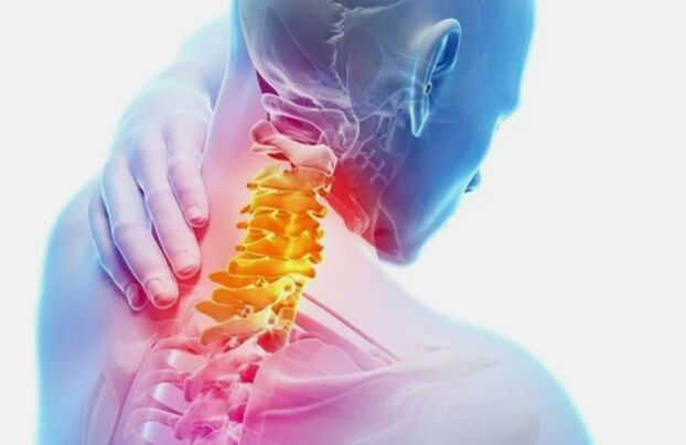 Osteochondrosis of the cervical region