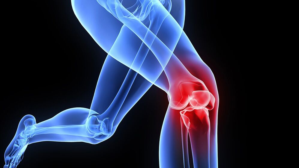 problems with knees due to arthrosis